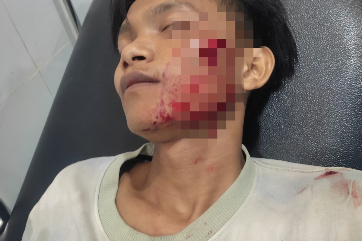 Mabuk Tuak, Pria Bacok Tiga Warga di&hellip;